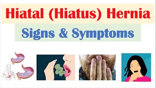 Hiatal Hiatus Hernia Signs amp Symptoms amp Why They Occur [upl. by Radke944]