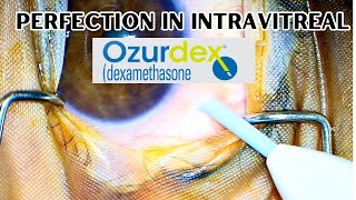 How to give intravitreal Ozurdex  Exercise right protocols from the beginning [upl. by Chelsie535]