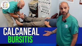 Calcaneal Bursitis  Ankle Pain [upl. by Julis]