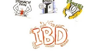 Inflammatory Bowel Disease IBD [upl. by Aneehta]