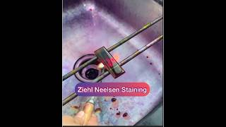 Ziehl Neelsen stainingZN stainingAFB staining Afb tb znstain [upl. by Navlys733]