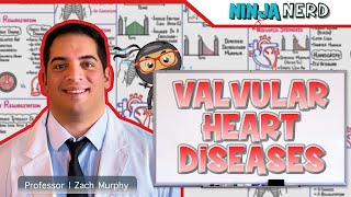 Valvular Heart Diseases  Clinical Medicine [upl. by Oirretna]