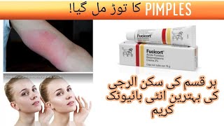 Fucicort Cream  Use Side Effects Benefits Price  review viral [upl. by Gemina]