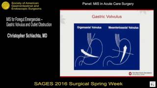 MIS for foregut emergencies  gastric volvulus and outlet obstruction [upl. by Nrubliw148]