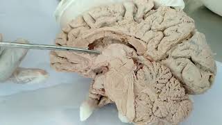 Lateral ventricle of BrainNeuroanatomy [upl. by Lenno937]