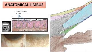 ANATOMY OF LIMBUS Dr Zain Khatib Video Lecture Series [upl. by Odnamra]