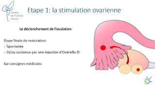 Insémination intrautérine  Aide médicale à la procréation AMP [upl. by Sib609]