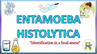 Entamoeba Histolytica  Morphology of the Trophozoite amp Cyst on Light Microscope Stools for AOC [upl. by Nitaf]