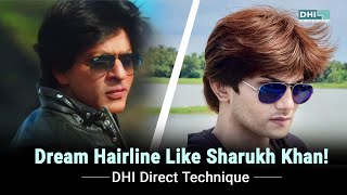 Dream Hairline like Sharukh Khan 📌  DHI India [upl. by Leunam]