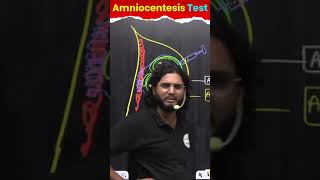 Amniocentesis Test क्या है 🔥🔥🔥 shorts ytshorts ‪lover [upl. by Joby956]