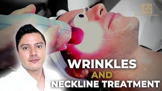 Laser Treatment for Wrinkles and Necklines with the CEO  Seoul Guide Medical  lasertreatment [upl. by Inahc]