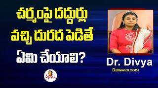 చర్మంపై దద్దుర్లు వచ్చి దురద పెడితే ఏమి చేయాలి  Dermatologist Dr Divya  Health Zone  VanithaTV [upl. by Alamak]