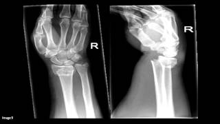 Approach to Orthopaedic Xrays [upl. by Barra]