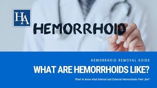 What Are Hemorrhoids Like Want to know what Internal and External Hemorrhoids Feel Like [upl. by Fraase217]