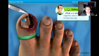 MOST DISGUSTING GAME EVER  Ingrown Toenail Surgery Simulator [upl. by Yendroc119]