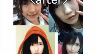 AKB48 History of Plastic Surgery Japanese TOP STAR [upl. by Haianeb]