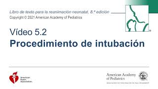 Procedimiento de Intubación Neonatal [upl. by Soutor]