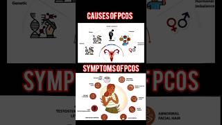 Polycystic Ovarian Syndromepcos pcod pcodtreatment pcosawareness pcosinfertility pcoslifestyle [upl. by Anastatius107]