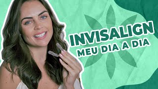 INVISALIGN  Meu dia a dia como funciona [upl. by Rehctelf]