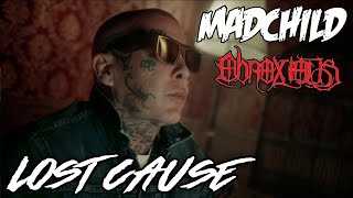 Madchild x Obnoxious  Lost Cause Official Music Video [upl. by Atrahc327]