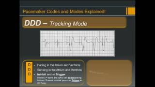 Pacemaker Codes and Modes  Explained [upl. by Poliard999]