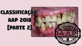 Parte 2 Classificação das Doenças Periodontais 2018  Nova Classificação da AAP 2018 [upl. by Selwin325]