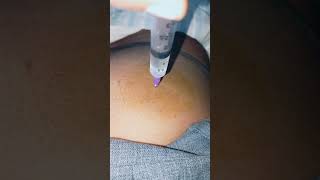 Hospital mein I M injection kis tarah lagaya hai is video mein 💉 short video Medicine Medical tips 🏥 [upl. by Deedee]