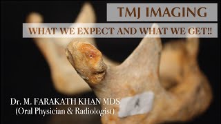 TMJ IMAGING  What we expect amp what we get [upl. by Aneba]