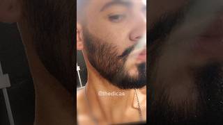 1 ANO USANDO MINOXIDIL evolução minoxidil minoxidil barba [upl. by Enoob]