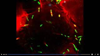 CH7 9 DETERMINANTS OF BACTERIAL PATHOGENESIS Intracellular survival [upl. by Boone]