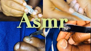 Asmr ATTENTIVE DEEP NAIL CLEANINGSatisfying feeling plus picking 😩😴 [upl. by Eelsew903]