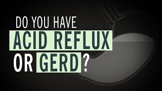 Do You Have Acid Reflux or GERD [upl. by Milissent]