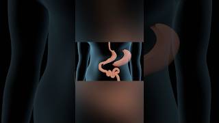 Sleeve Gastrectomy medicalanimation health shorts [upl. by Anitselec69]