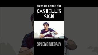 What is Castell’s sign in splenomegaly shorts splenomegaly spleenanatomy [upl. by Aneeuq139]