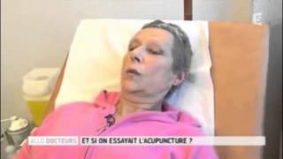 Séance dacupuncture durant une chimiothérapie traitement du cancer [upl. by Yatzeck]