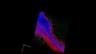 The JI  HydroxypropylβCyclodextrin Spikes Local Inflammation That Induces Th2 Cell [upl. by Trent933]