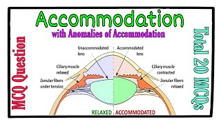 MCQ  Accommodation and its Anomalies [upl. by Kronfeld]