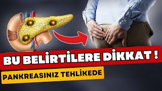 Pankreasınızın Hasta olduğunu Gösteren 5 belirti  Pankreatit ve tedavisi  Pankreas iltihabı [upl. by Baecher]