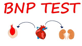 Brain Natriuretic Peptide BNP Test for heart failure [upl. by Mcgean]