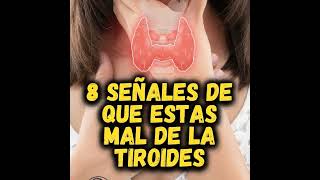 8 Señales de que sufres de TIROIDES 😳 [upl. by Irtak176]