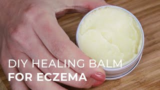 Tutorial for making a Natural Healing Cream for Eczema and Psoriasis [upl. by Hameean]