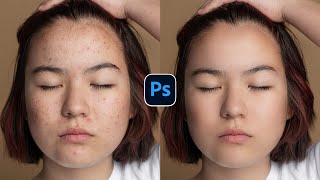 How to Retouch Skin and Remove Blemishes in Photoshop  Skin Retouching [upl. by Nymsaj]