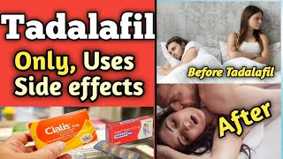 Tadalafil  Tadalafil 20mg Tablet Uses in Hindi [upl. by Gunilla728]