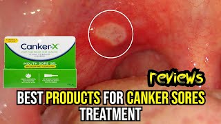 🌟 Banish Canker Sores FAST Top 3 Treatments Reviewed amp How to Use Them 🔥 [upl. by Ecidnak317]