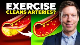 This Exercise Clears Plaque in Your Arteries New Trial [upl. by Castro]