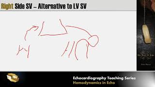 Lecture 8  Hemodynamics in Echocardiography [upl. by Nois]