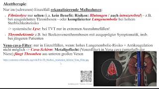 TVT  tiefe Venenthrombosen  Phlebothrombose [upl. by Laitselec]