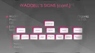 Malingering Waddells Signs [upl. by Squier]