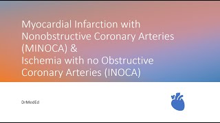 Myocardial Infarction with Nonobstructive Coronary Arteries MINOCA amp INOCA [upl. by Ileak917]