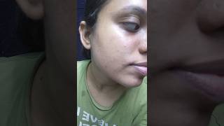 Watch this before using Tretinoin Skin transformation  Tretinoin 4 months update [upl. by Nyleak]